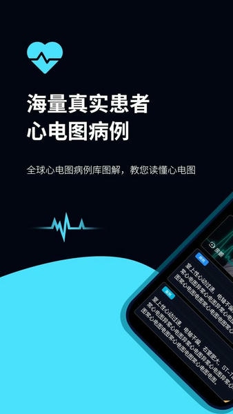 心电图ECG手机版 v2.1 安卓版 0