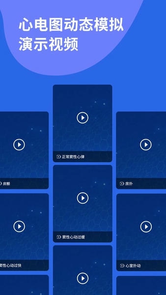 心电图ECG手机版 心电图ecg软件下载