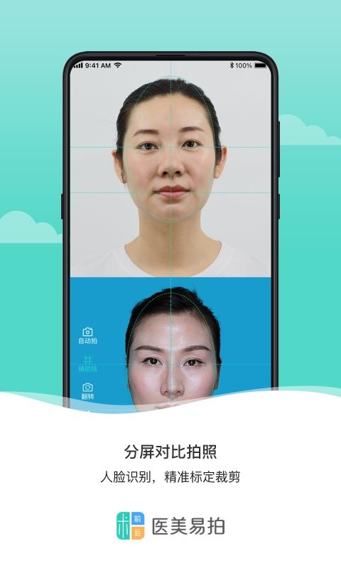 医美易拍手机版 v2.0.3 安卓版 0