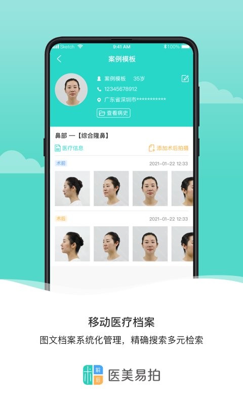 医美易拍手机版 v2.0.3 安卓版 1
