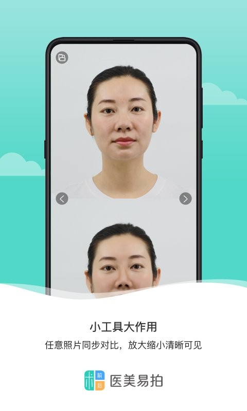 医美易拍手机版 医美易拍app下载安装