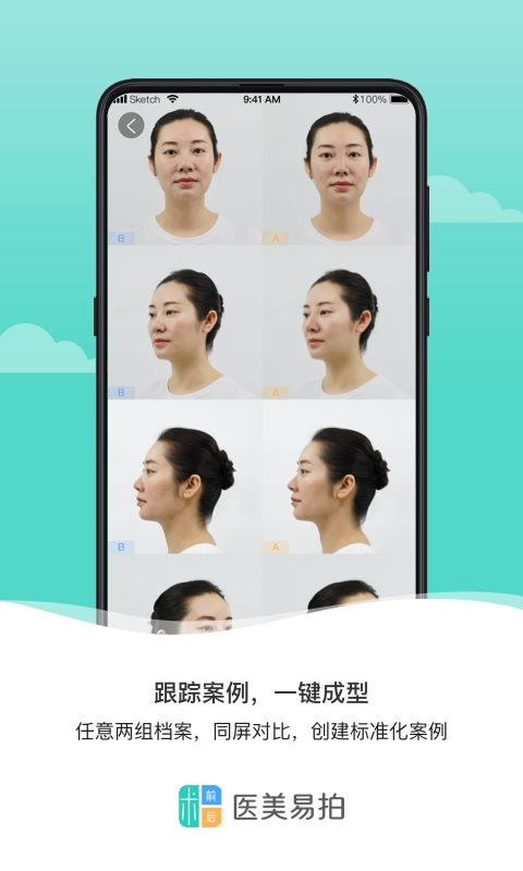 医美易拍手机版 v2.0.3 安卓版 2