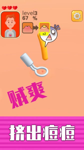 挤痘贼爽小游戏官方版 v1.0.0 安卓版 3