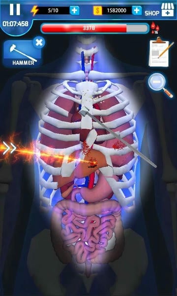 手术大师中文版(Surgery Master) v1.7 安卓版 1