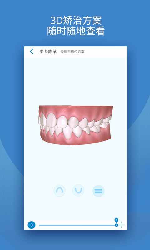 iortho下载 iortho时代天使手机app