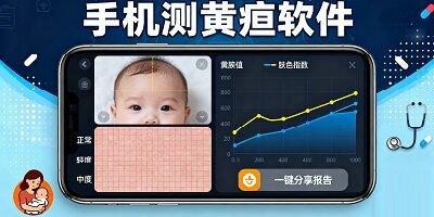 测黄疸软件