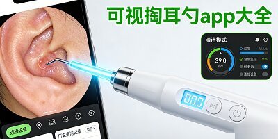 可视掏耳勺app